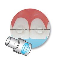 Mini Mold® – Bracket